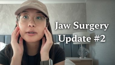 Jaw Surgery Relapse Part 2 | Three-Month Update With Photos!