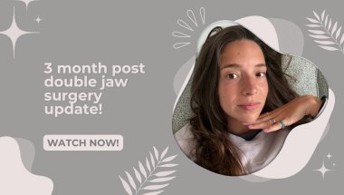 3 month post double jaw surgery update