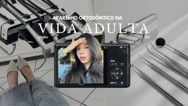 APARELHO NA VIDA ADULTA | Colocando aparelho fixo