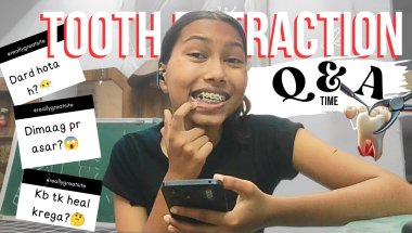 🦷TOOTH EXTRACTION Q&A : Everything You Need to Know!