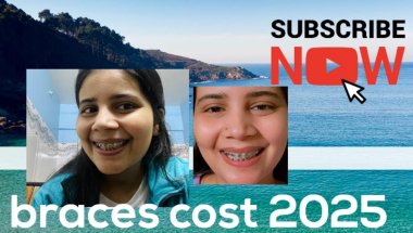 Braces price 2025#teethbraces #teeth #braces #viral #trending #vlog #viralvideo #top #dentalbraces