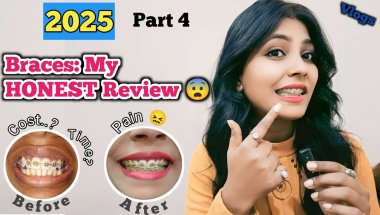Braces: My HONEST Review - What I Wish I Knew BEFORE Getting Them Part 4 (2025) #braces #trending
