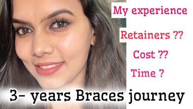 My Braces experience + Retainers journey ||Braces transformation #braces#teeth#retainers