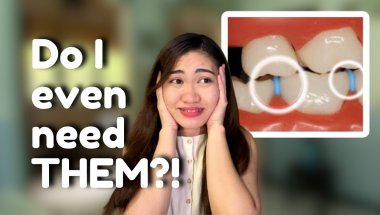 What are the painful stages with having Braces? Find Out!