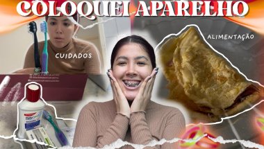 Coloquei Aparelho, cuidados+ alimentação e dia a dia.