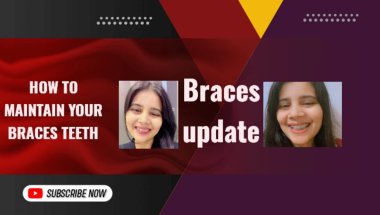 Braces maintenance #viral #teeth #braces #trending #mumbai #vlog #virslshorts #viralvideo #shortsfee