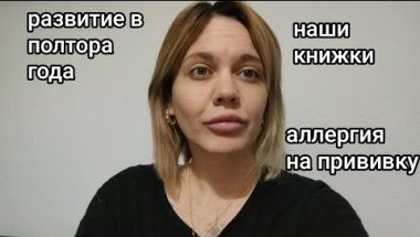 Развитие в полтора года / Наши книжки / Аллергическая реакция на прививку от гриппа