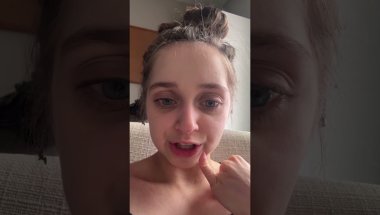 Shauna Rae: Invisalign Day 38