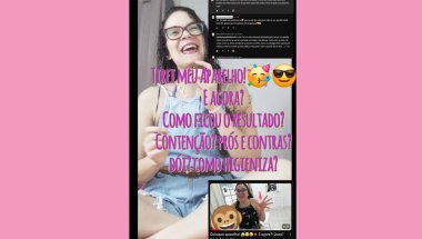 🔥Tirei meu Aparelho!🥳😎 E agora? Resultado+Contenção+Cuidados+Dúvidas😱🔥✨️#aparelhodental #respondendo