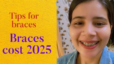 Braces cost 2025,Pain,Time 😱#viral #trending #teethbraces #braces #shortsfeed #shortvideo #teeth