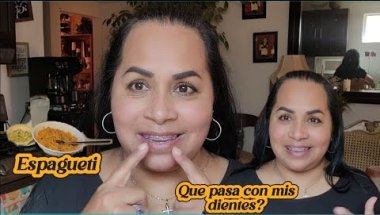 Story time sobre mi falsa dentadura