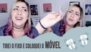 DIÁRIO DO APARELHO: 2 anos e 11 meses | APARELHO MÓVEL + ANTES E DEPOIS