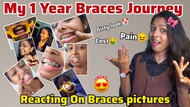 😂 My 1 Year Complete with Braces ||Before VS Now Result 🤭 Funny Reaction on Old Braces Pictures 🦷🥹❤️