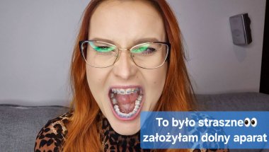 To było najgorsze.. Zakładam dolny łuk aparatu .