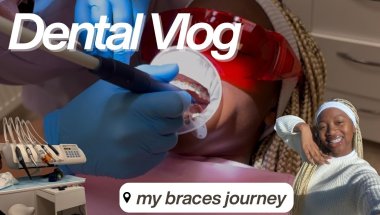 VLOG : Getting my first dental wash 🪥and powerchains | New braces colours || Zimbabwean YouTuber