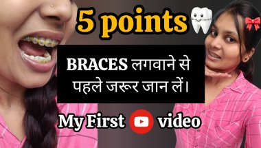 To know before getting braces ||🦷#bracestransformation #bracesjourney #dentist #braces
