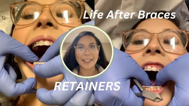 Life After Braces: Wearing RETAINERS for the first time | vlog