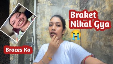 Braces ka Braket Nikal Gya 🙄I don’t How 🤔