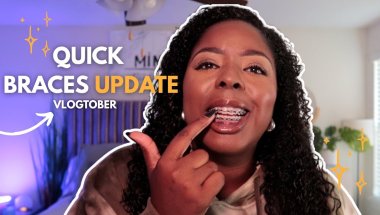 Living with Braces in My 30s | Quick Update