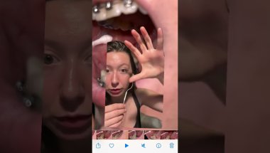 Заплатила 30т за ЭТО😵‍💫 это 2 часть. Первая о брекетах в профиле