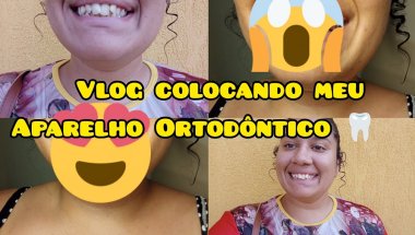 Vlog colocando meu Aparelho Ortodôntico 🦷-Allana Mayra