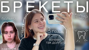 БРЕКЕТЫ: моя история лечения в 3 года