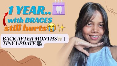 I Survived 1 Year With BRACES 😭🦷 | Honest Update! | pain + Glow up + Come back 💖|