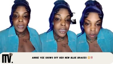 ANNIE YEE SHOWS OFF HER NEW BLUE BRACES😳‼️