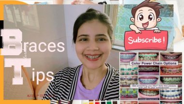 Braces tips#viral #trending #dentaltreatment #dentaltreatment #dentalbraces #youtuber #viralvideo