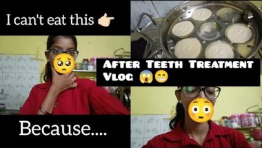 After Teeth Treatment 😱😁/ Kuch Kha nhi pa rhi 😭