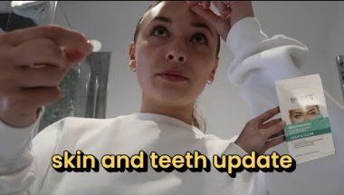 skin and teeth update