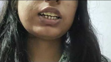 Braces experience🥰😒 retrainer kya h 👍?!#smiledesigndental  #braces #bracestransformation #retrainer