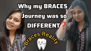 Not the Typical Braces Journey🦷|| मेरी Braces Journey अलग क्यों रही❓