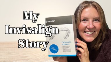 My Invisalign Transformation | Was It Worth It? A Midlife & Beyond Chat 💫