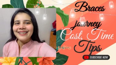 How braces completely changed my life#trending #youtube #viralvideo #teeth #braces