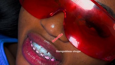 TEETH BRACES￼/ LIFE STYLE OF A SINGLE GIRL IN NIGERIA/ BEST BRACES