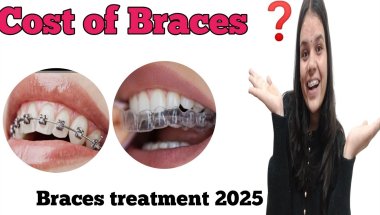 Cost of Braces in india🤔//Metal braces /ceramic braces/aligners 🦷