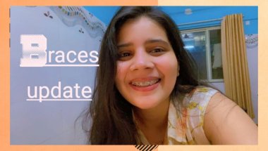 Braces update #viral #trending #vlog #minivlog #teeth #braces