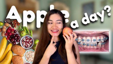 TOP Foods to Eat with Braces for a Healthy Smile