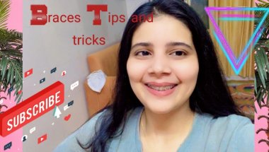 Braces tips#viral #smiledesigndental #dentalcare #vlog #trending #youtube