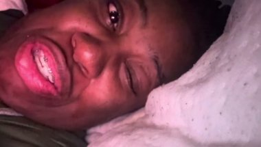 Gastric Bypass Didn’t Erase My Hunger — It Broke My Heart #fypシ