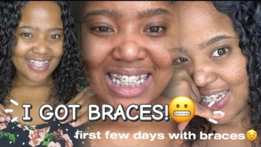 I GOT BRACES | they are so cheap! | first few days are HELL😭😩 documenting the first few days! 🇿🇦