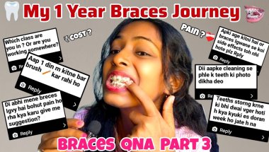 😱 Q&A On Braces Part 3 || 😍Answering All your Questions About Braces Cost, Pain & Duration🦷#trending