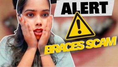 Braces or scam😥#explore #braces