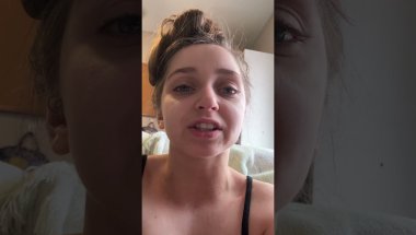 Shauna Rae: Invisalign Day 56