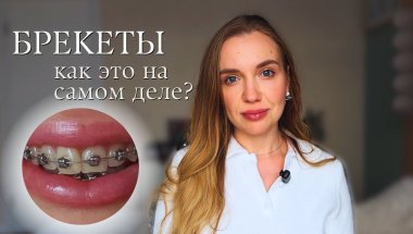 Брекеты: боль, уход и настоящая цена красивой улыбки