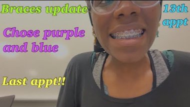 Braces update - the final appointment (13)!