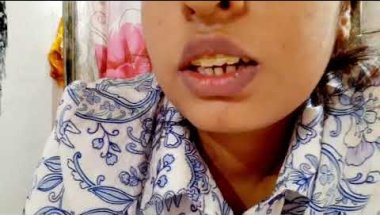 My four months complete! :☺☺my  experience with braces #braces #lsmile #transformationjourney