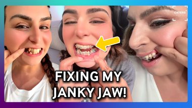 My Braces Journey: The Pain, The Glow-Up, The Confidence ✨🦷