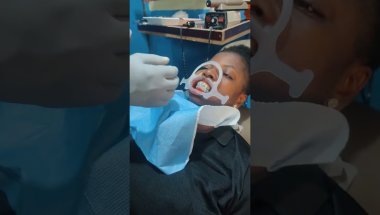 Braces installation